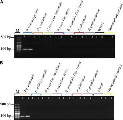 Real-Time PCR for Diagnosing and Quantifying Co-infection by Two Globally Distributed Fungal Pathogens of Wheat